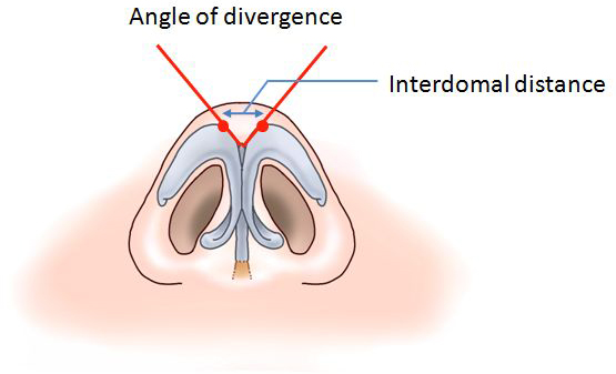 Angle of divergence